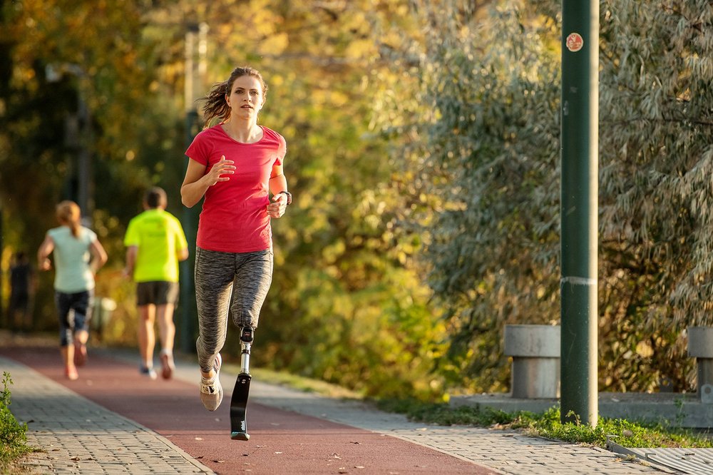 Woman with a prosthetic leg jogging